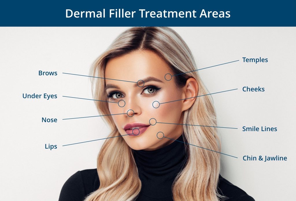 Dermal filler treatment areas include brows, temples, under eyes, cheeks, nose, smile lines, lips, chin, and jawline.