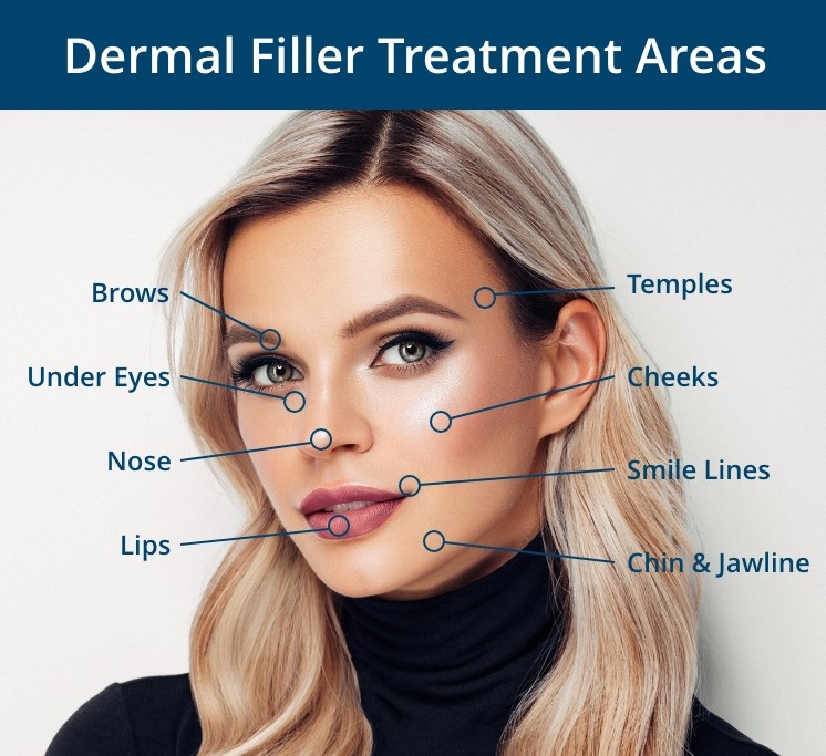 Dermal filler treatment areas include brows, temples, under eyes, cheeks, nose, smile lines, lips, chin, and jawline.