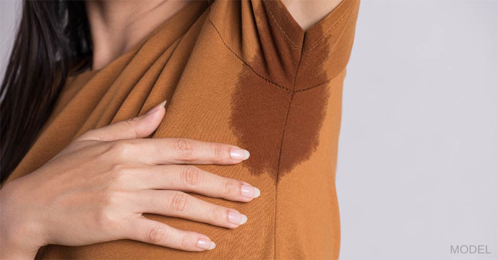 Woman with sweat stains from excessive sweating (model)